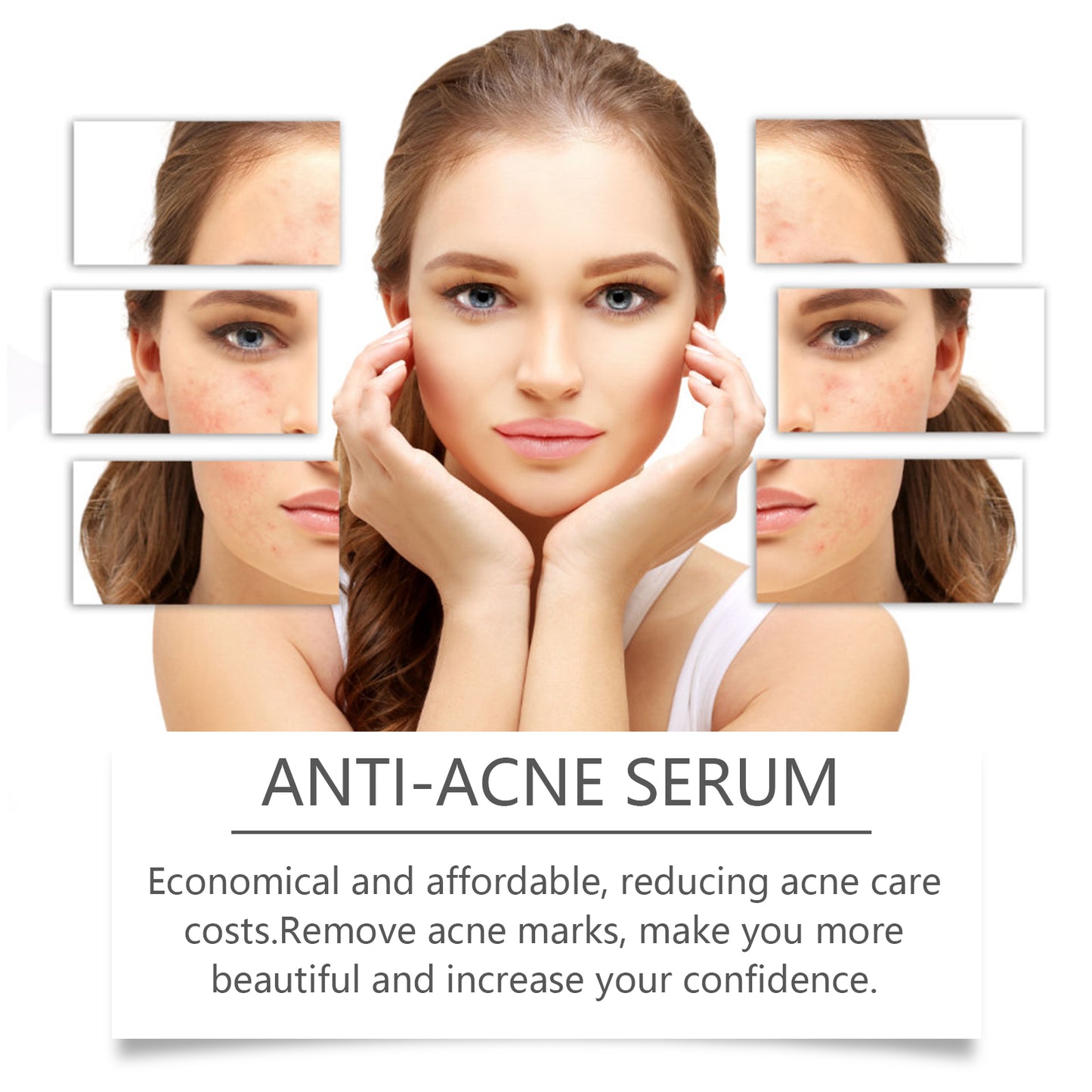 Siero anti-acne Hoygi alla nicotinamide Siero delicato anti-acne Migliora l'acne Siero idratante riparatore