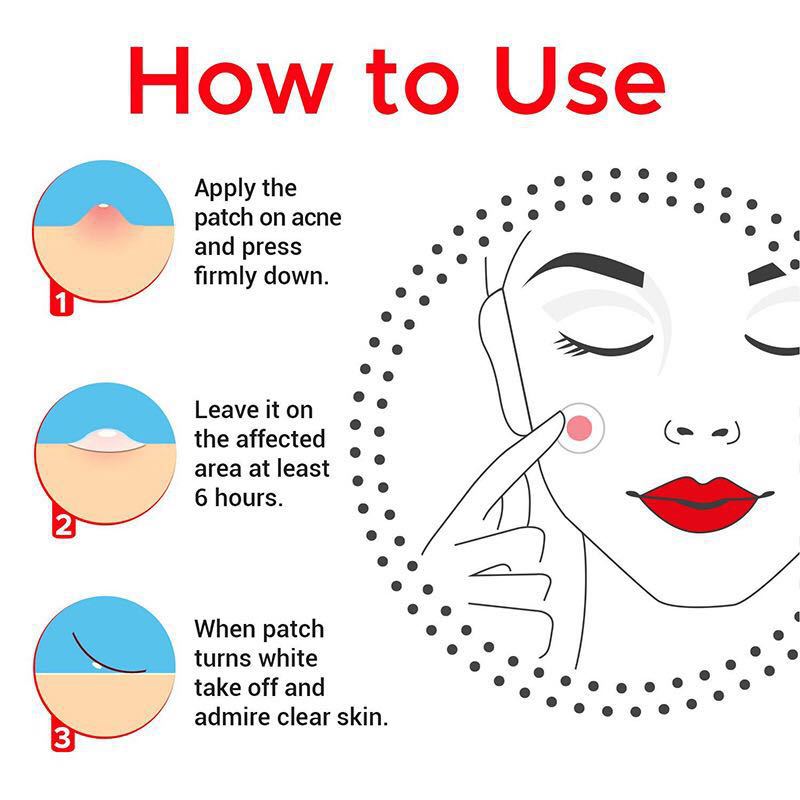 Cerotto idrocolloidale impermeabile anti-acne per ridurre i segni dell'acne