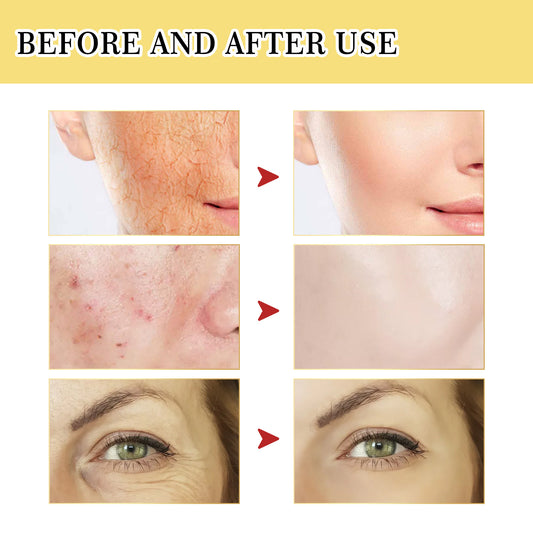 Siero Viso Originale al Collagene e Bava di Lumaca