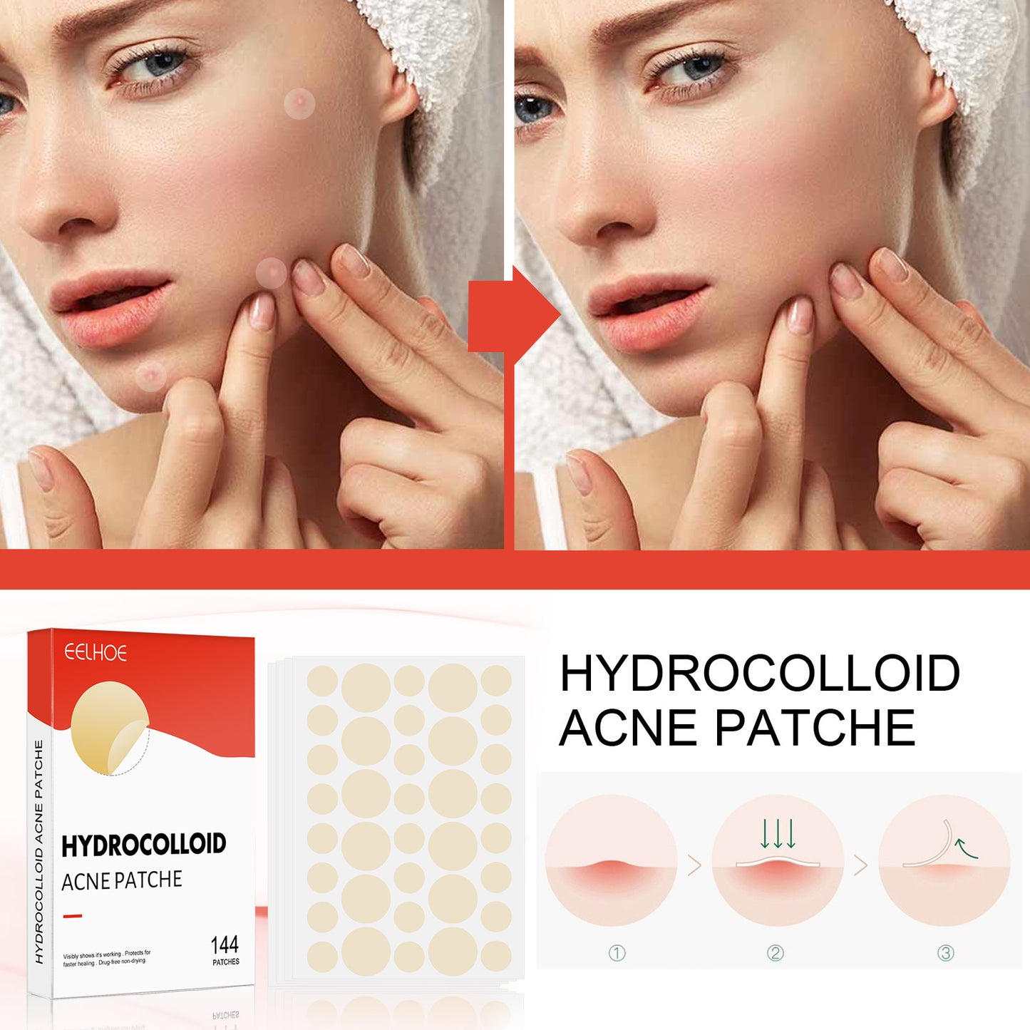 Cerotto per acne idrocolloidale Cerotto per acne chiusa da trucco