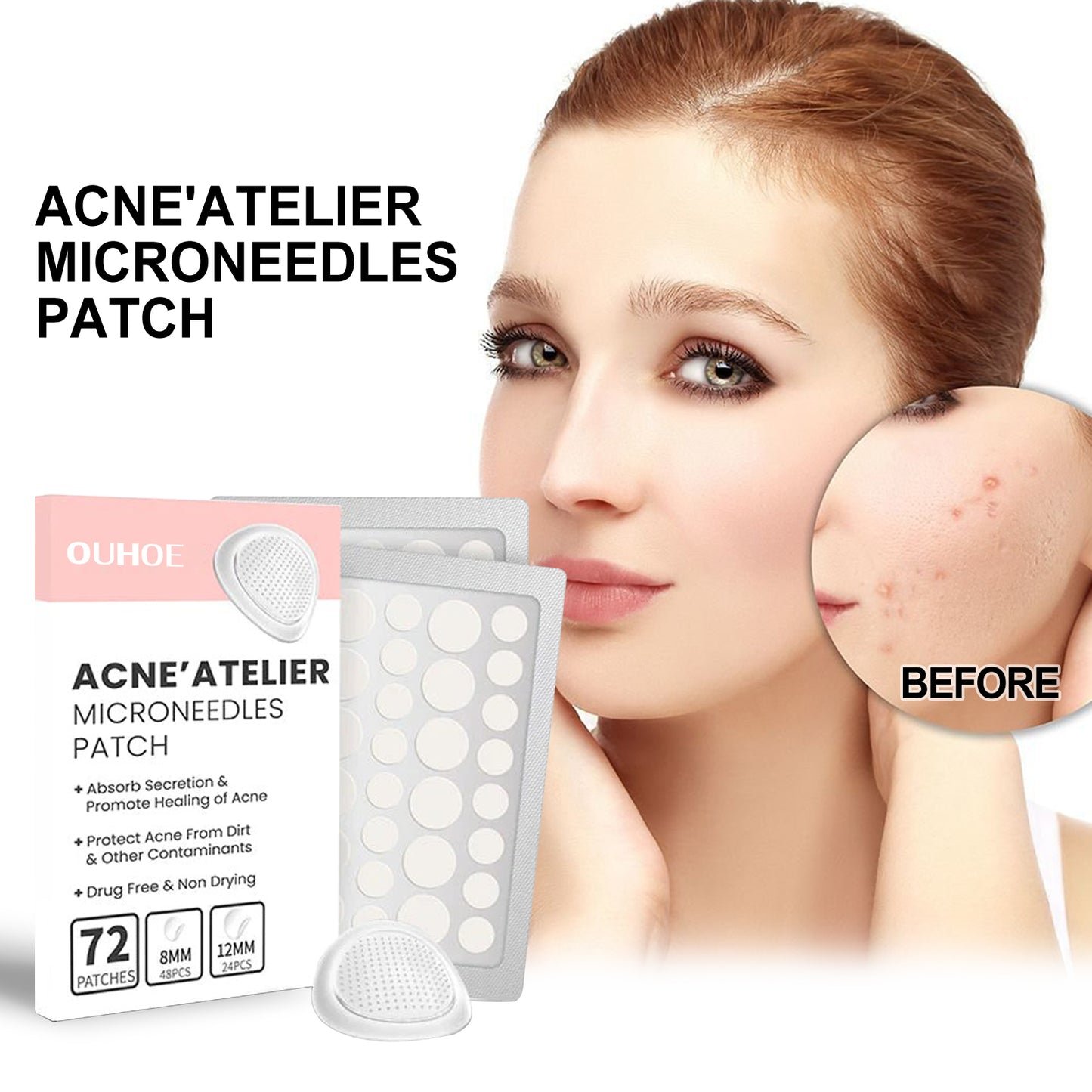 OUHOE Acne Patch Ripara l'Acne, Riduce il Rossore, Pulisce i Pori e Idrata
