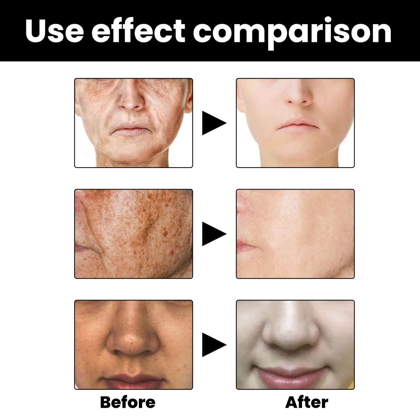 Produtos Hidratantes para o Cuidado da Pele para Reparação da Melanina Facial