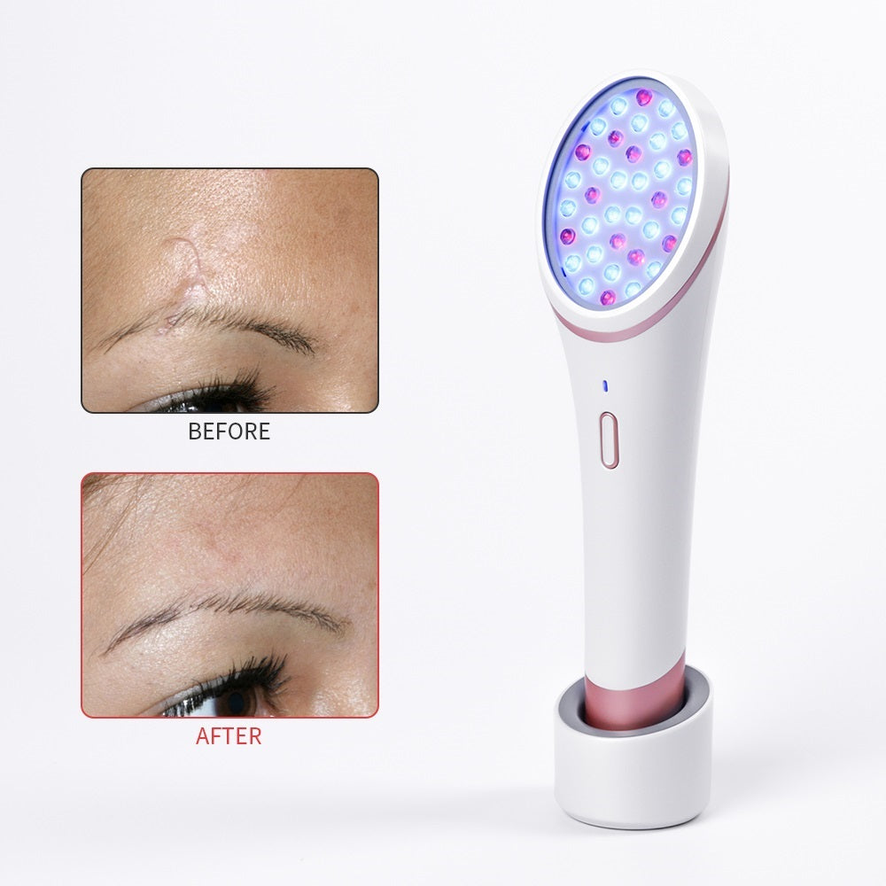 Removedor de acne iridescente