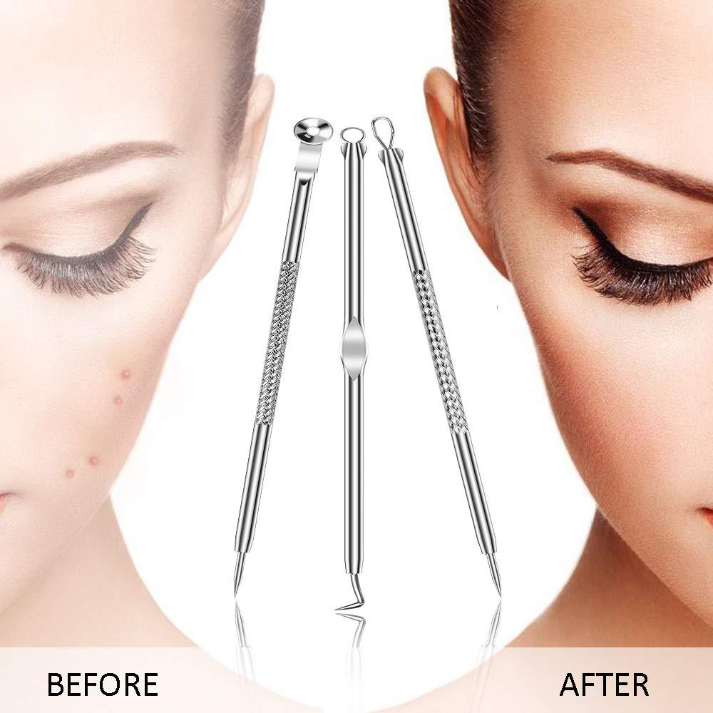 Set da 7 aghi per acne galvanizzati, set di aghi per rimuovere punti neri e acne
