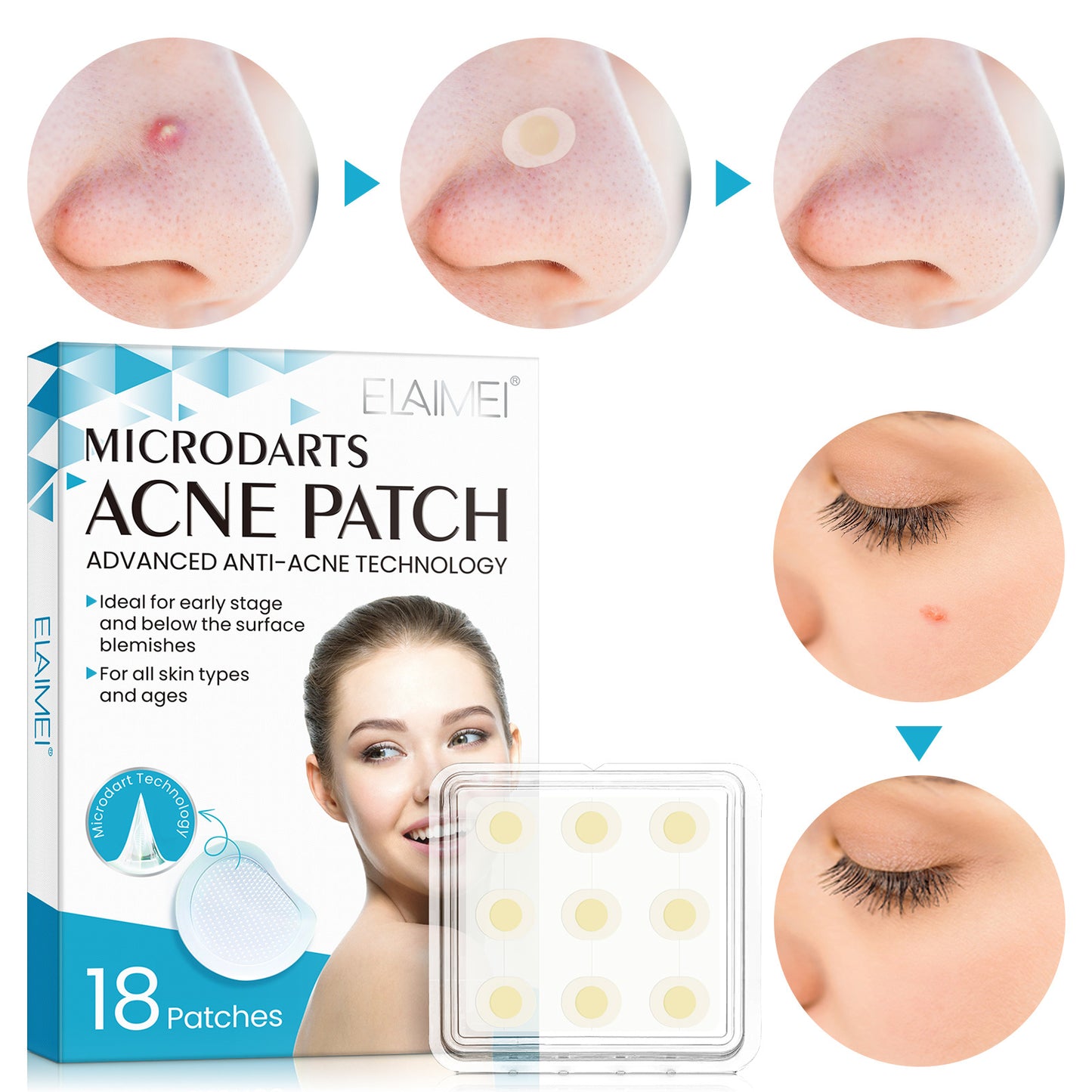 Novo adesivo hidrocoloide para acne com microagulhas