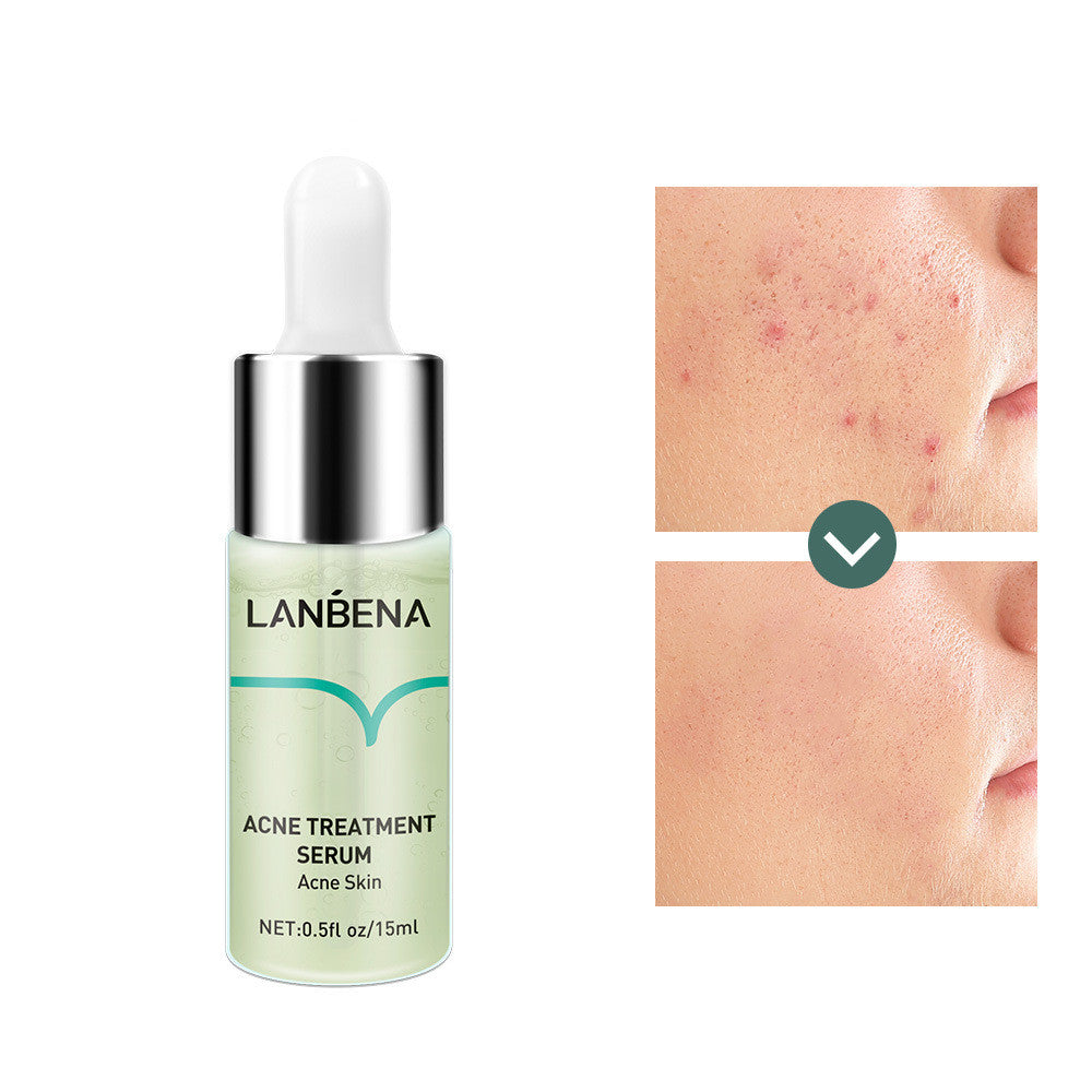 Lambina Liquido Originale Anti-acne per la Riparazione e l'Attenuazione dei Segni dell'Acne