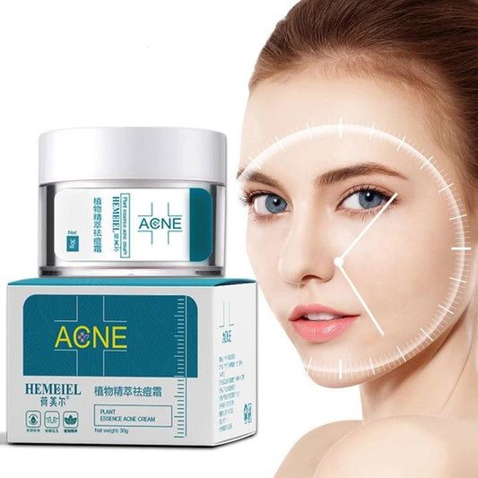 Creme para acne