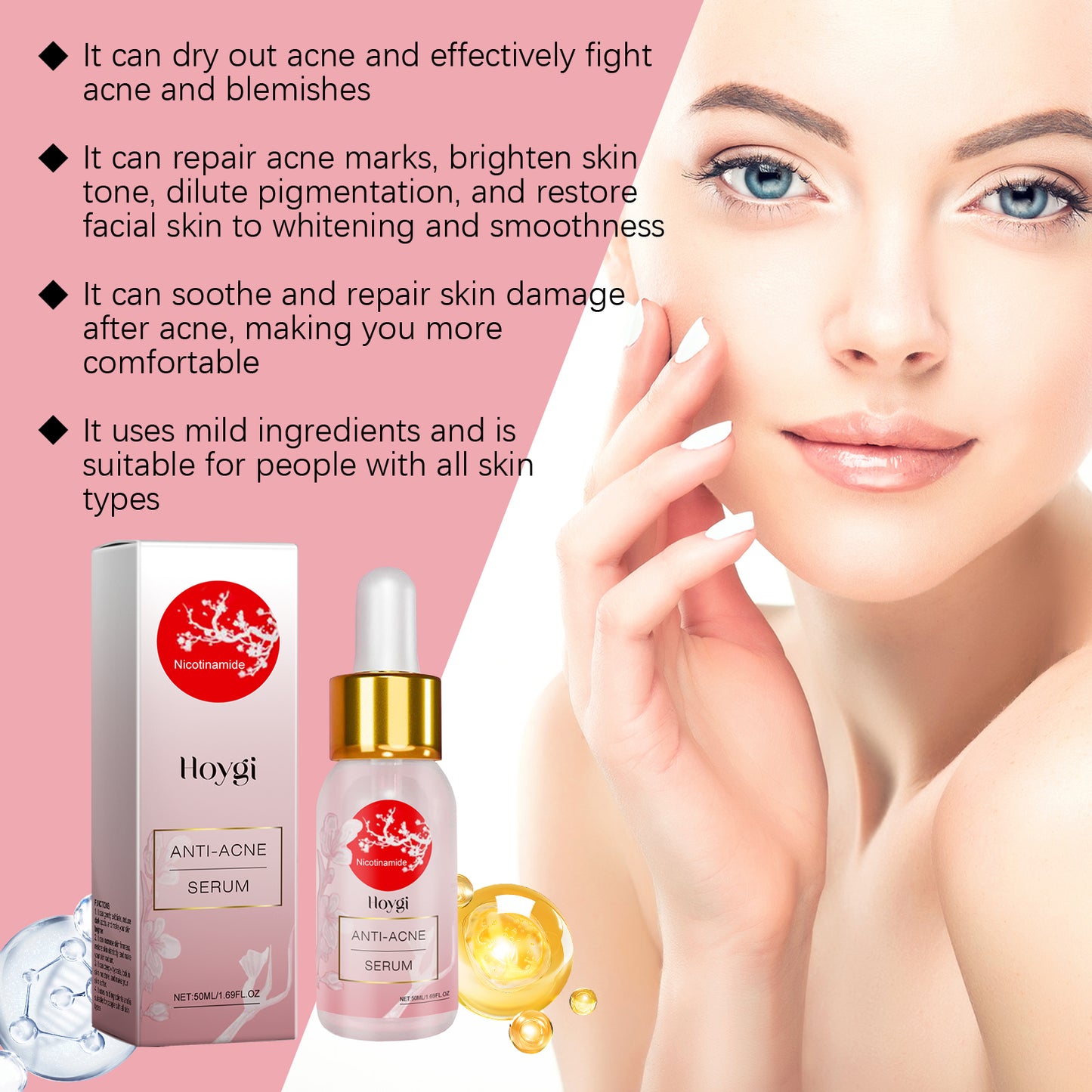 Siero anti-acne Hoygi alla nicotinamide Siero delicato anti-acne Migliora l'acne Siero idratante riparatore