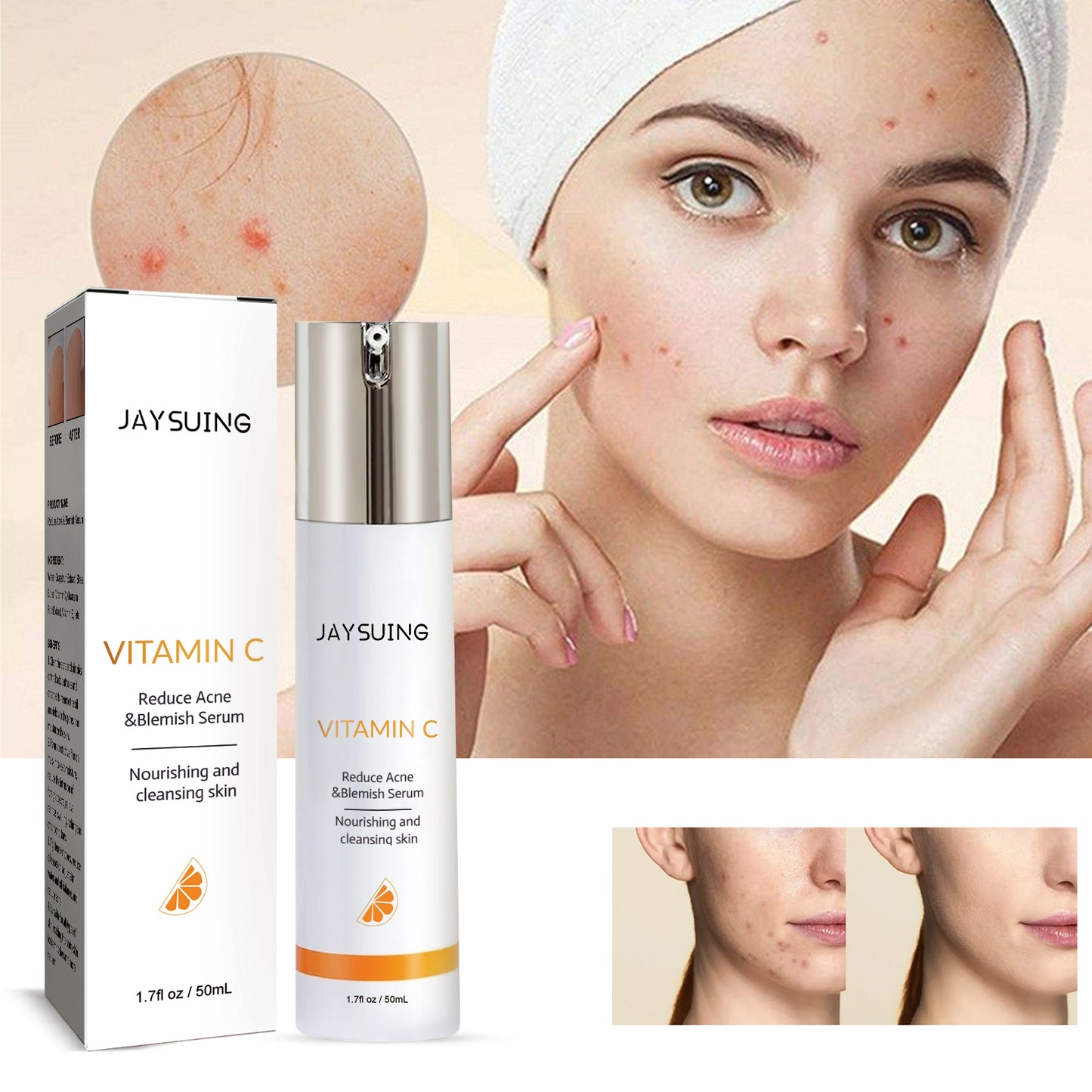 Jayusing Siero Anti-Acne e Anti-Macchie, Riduce Acne e Segni di Acne, Siero Idratante Riparatore per la Pelle