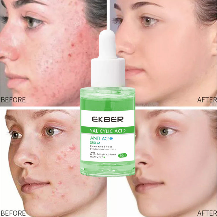 Antiacne schiarente idratante, riparatore e purificante
