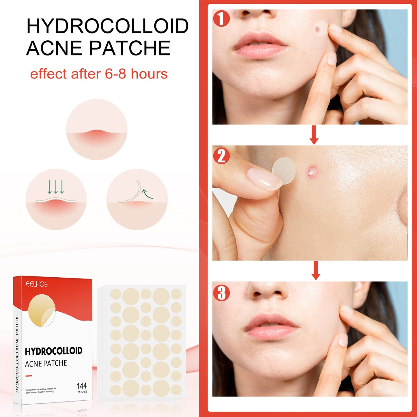 Cerotto per acne idrocolloidale Cerotto per acne chiusa da trucco