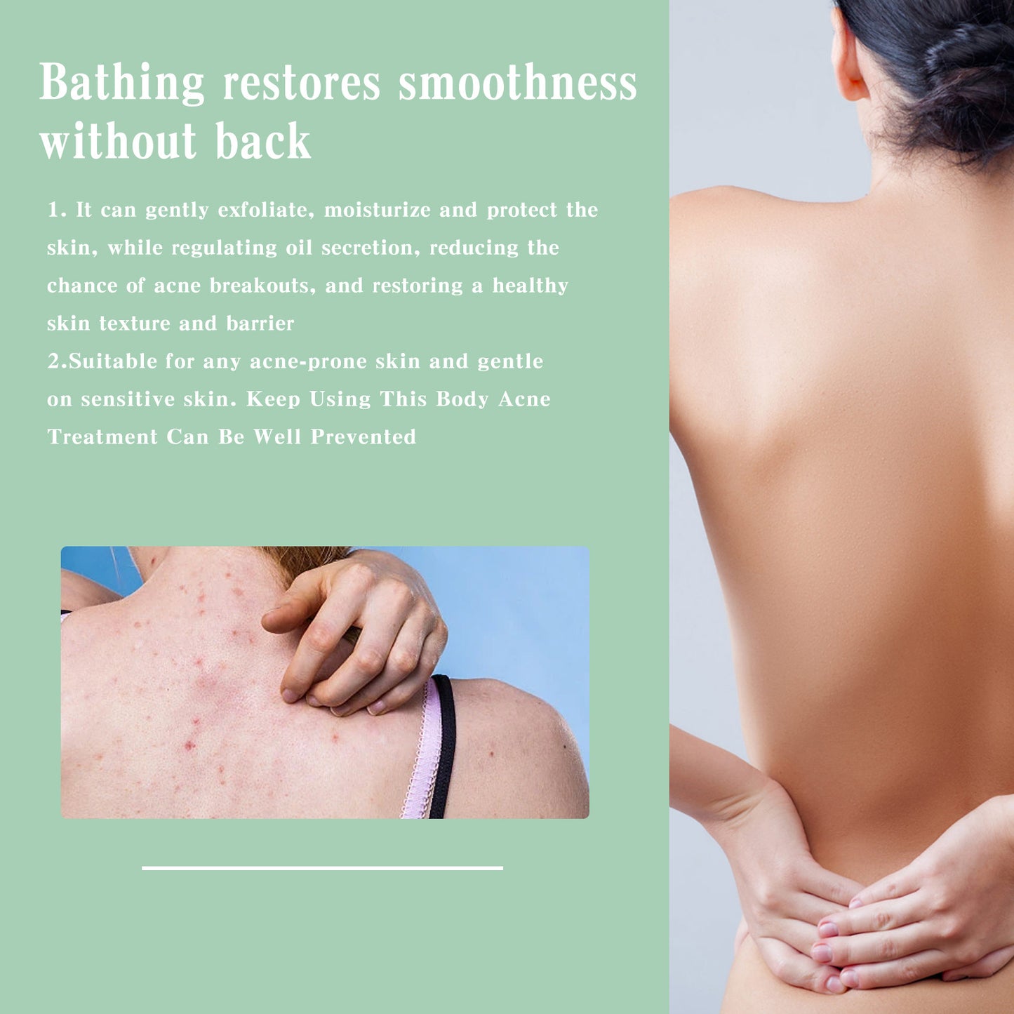 Spray riparatore per acne sulla schiena, sulle spalle, dissalazione dell'acne, segni dell'acne, cura della pelle