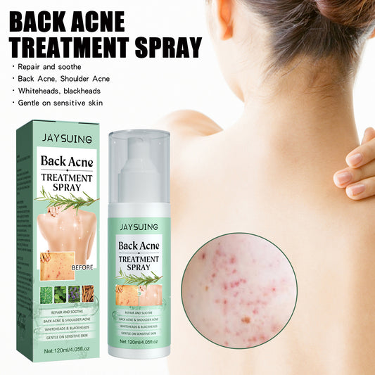 Spray Para Cuidados Com a Pele Contra Acne Nas Costas, Ombros, Despigmentação e Marcas de Acne