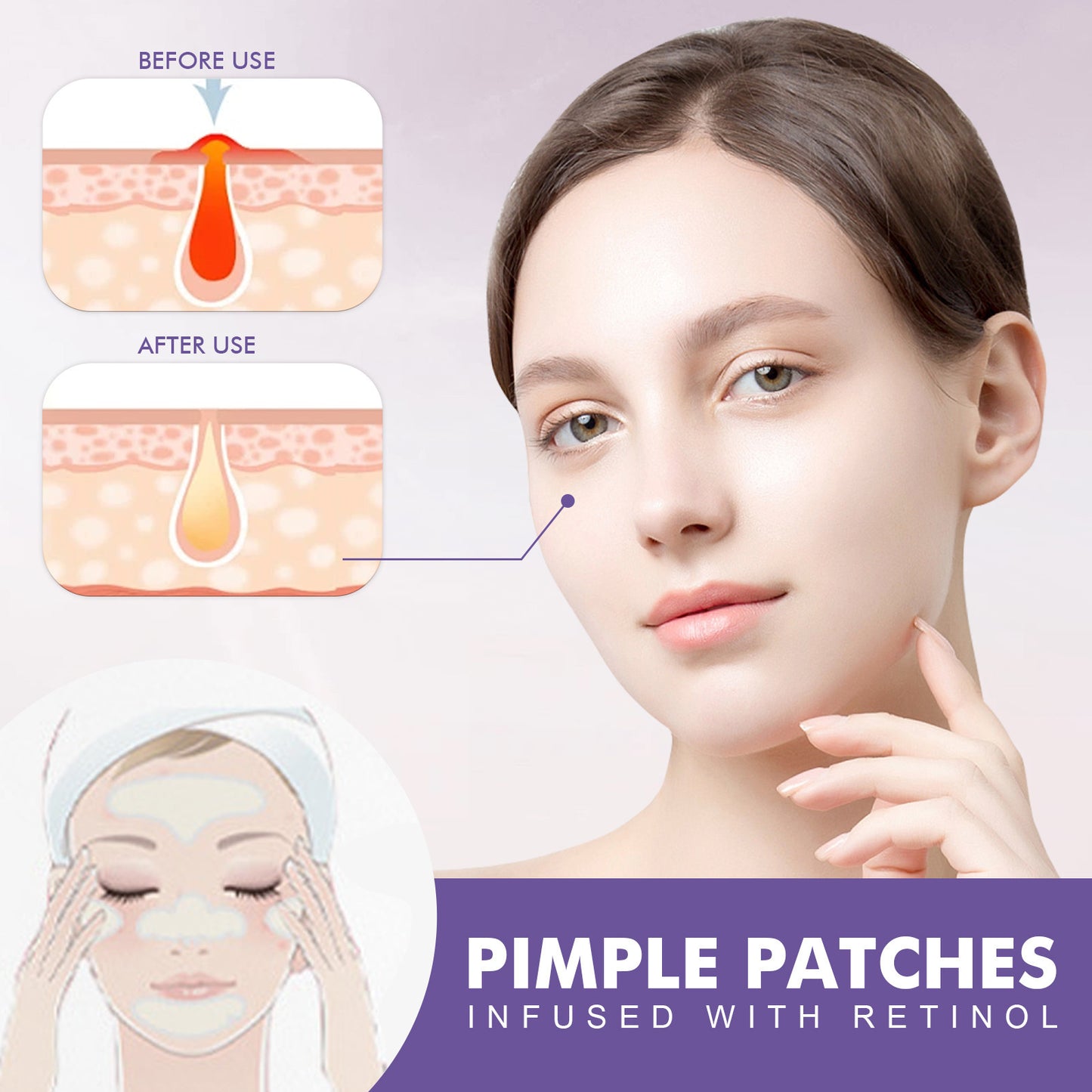 Adesivo para Acne na Bochecha Antiacne Dilui Cicatrizes de Acne