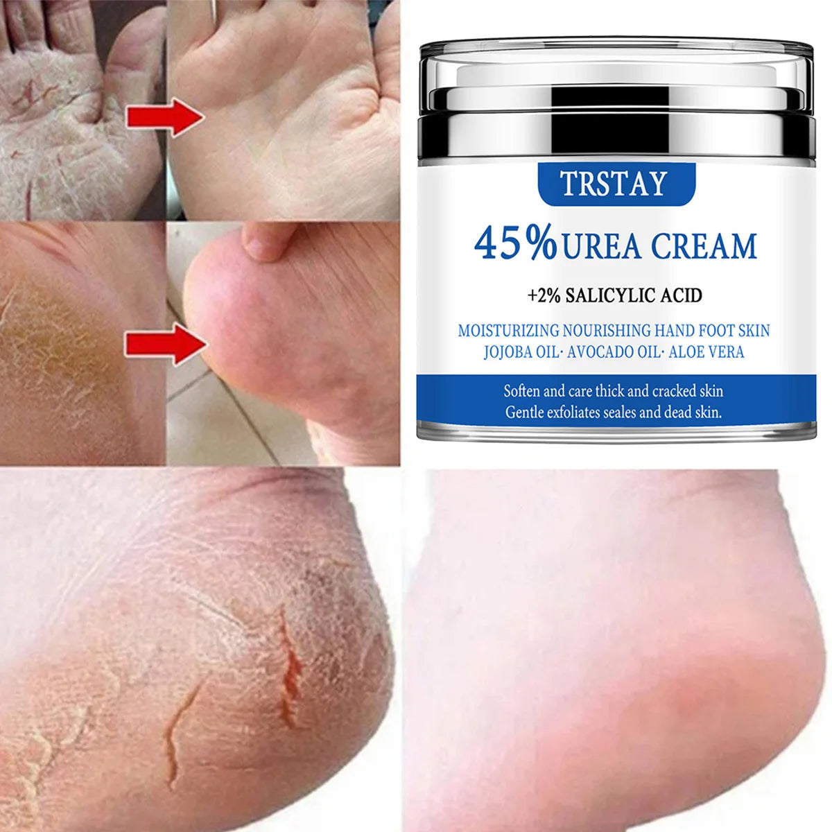 Crema all'urea al 45% + acido salicilico al 2% TRSTAY idrata e nutre la pelle di mani e piedi con olio di jojoba, olio di avocado e aloe vera