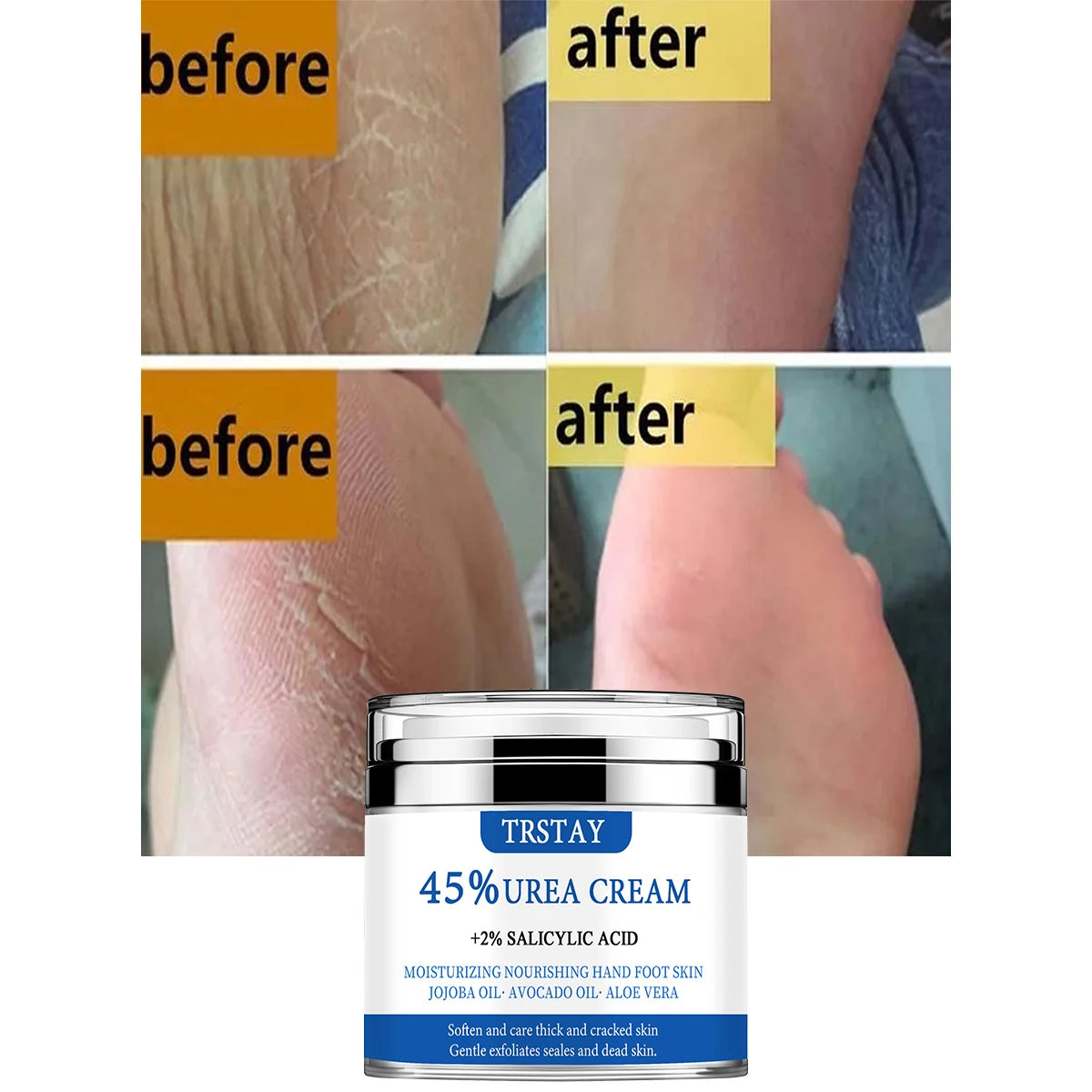 Crema all'urea al 45% + acido salicilico al 2% TRSTAY idrata e nutre la pelle di mani e piedi con olio di jojoba, olio di avocado e aloe vera