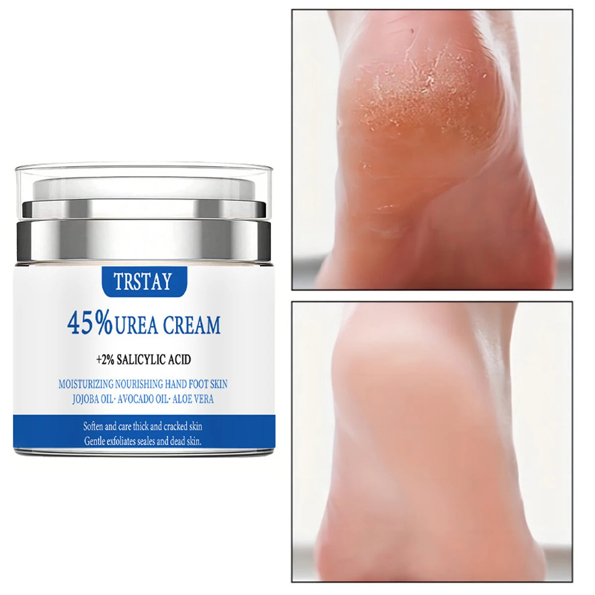 Crema all'urea al 45% + acido salicilico al 2% TRSTAY idrata e nutre la pelle di mani e piedi con olio di jojoba, olio di avocado e aloe vera