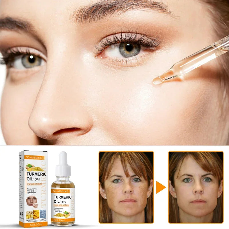 Rimuove le macchie scure, olio essenziale di curcuma, siero viso antirughe, terapeutico per l'acne, restringimento dei pori, sbiancante, idratante per la cura della pelle