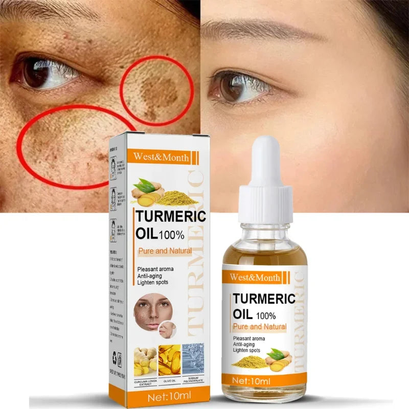 Rimuove le macchie scure, olio essenziale di curcuma, siero viso antirughe, terapeutico per l'acne, restringimento dei pori, sbiancante, idratante per la cura della pelle