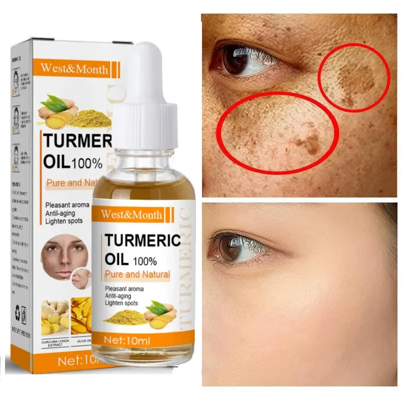 Rimuove le macchie scure, olio essenziale di curcuma, siero viso antirughe, terapeutico per l'acne, restringimento dei pori, sbiancante, idratante per la cura della pelle