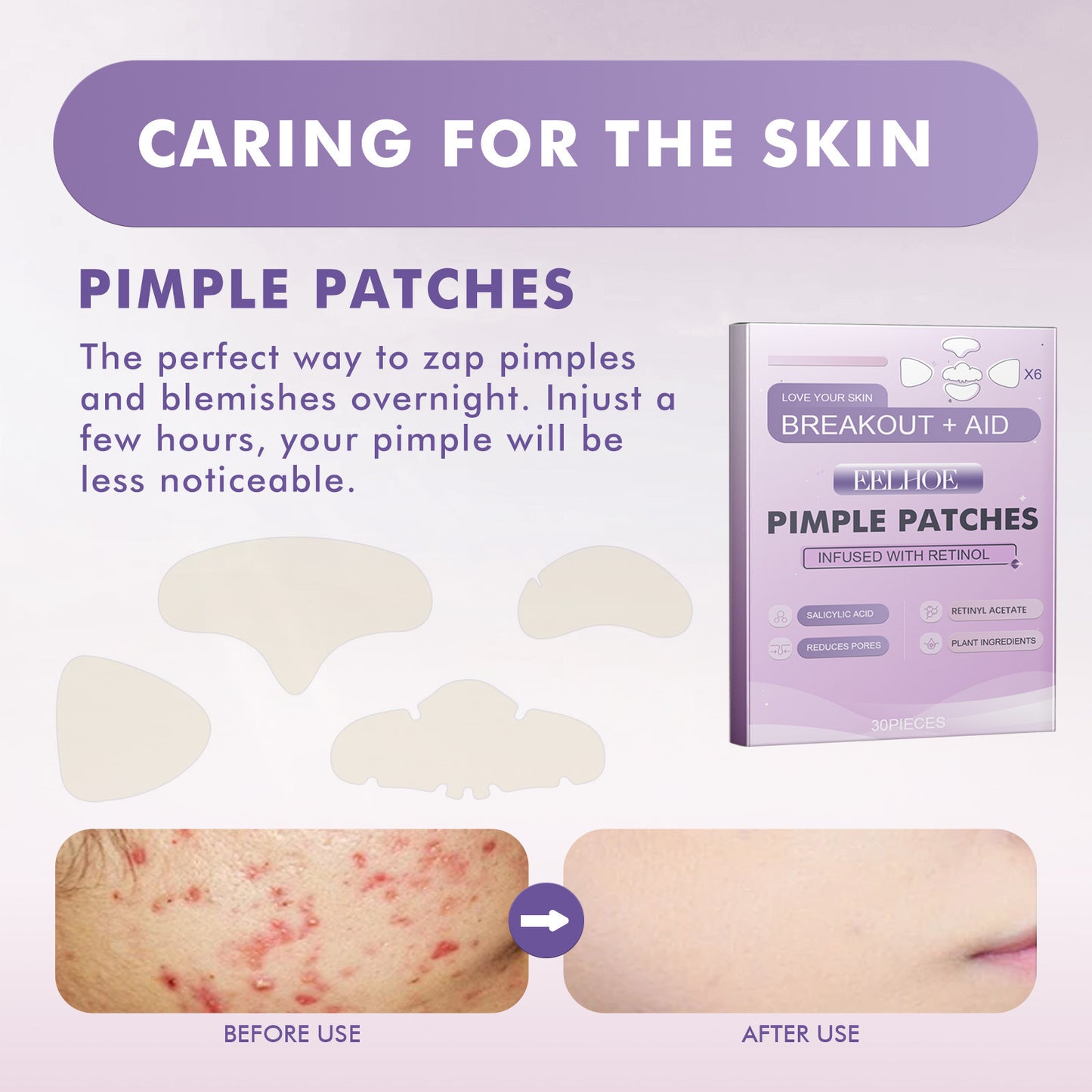 Adesivo para Acne na Bochecha Antiacne Dilui Cicatrizes de Acne