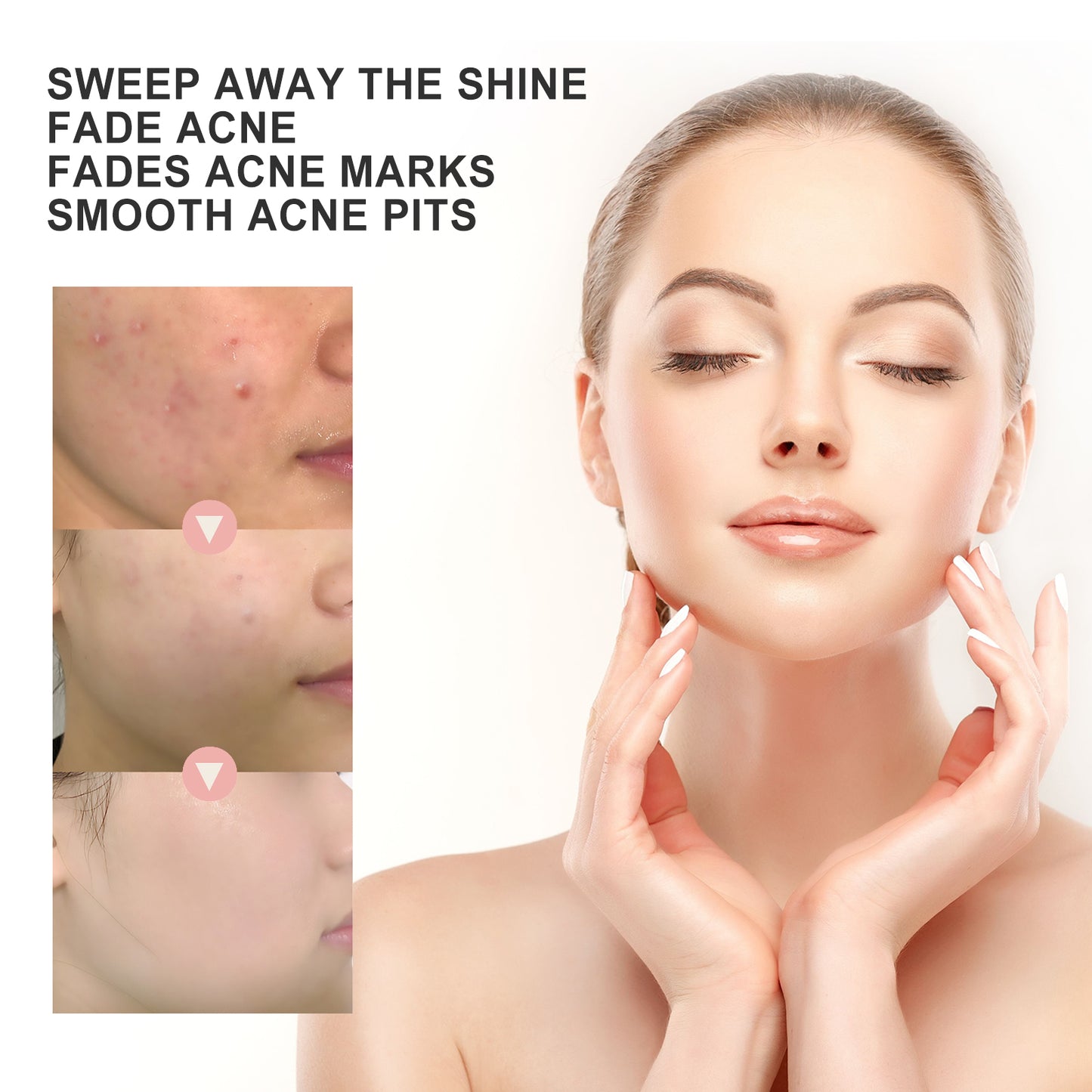 OUHOE Acne Patch Ripara l'Acne, Riduce il Rossore, Pulisce i Pori e Idrata