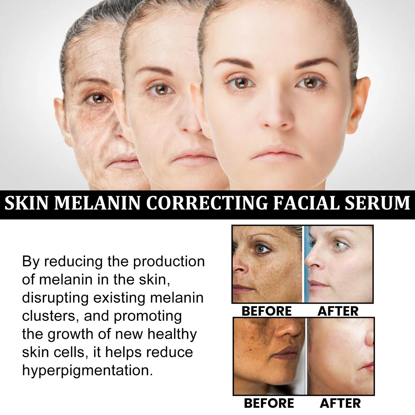 Produtos Hidratantes para o Cuidado da Pele para Reparação da Melanina Facial