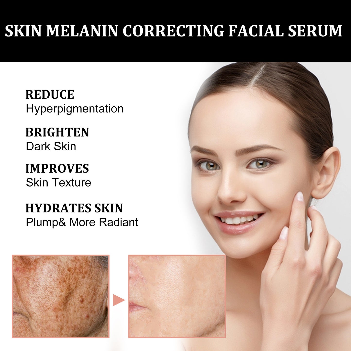 Produtos Hidratantes para o Cuidado da Pele para Reparação da Melanina Facial