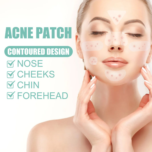Adesivo para Remover e Clarear a Acne